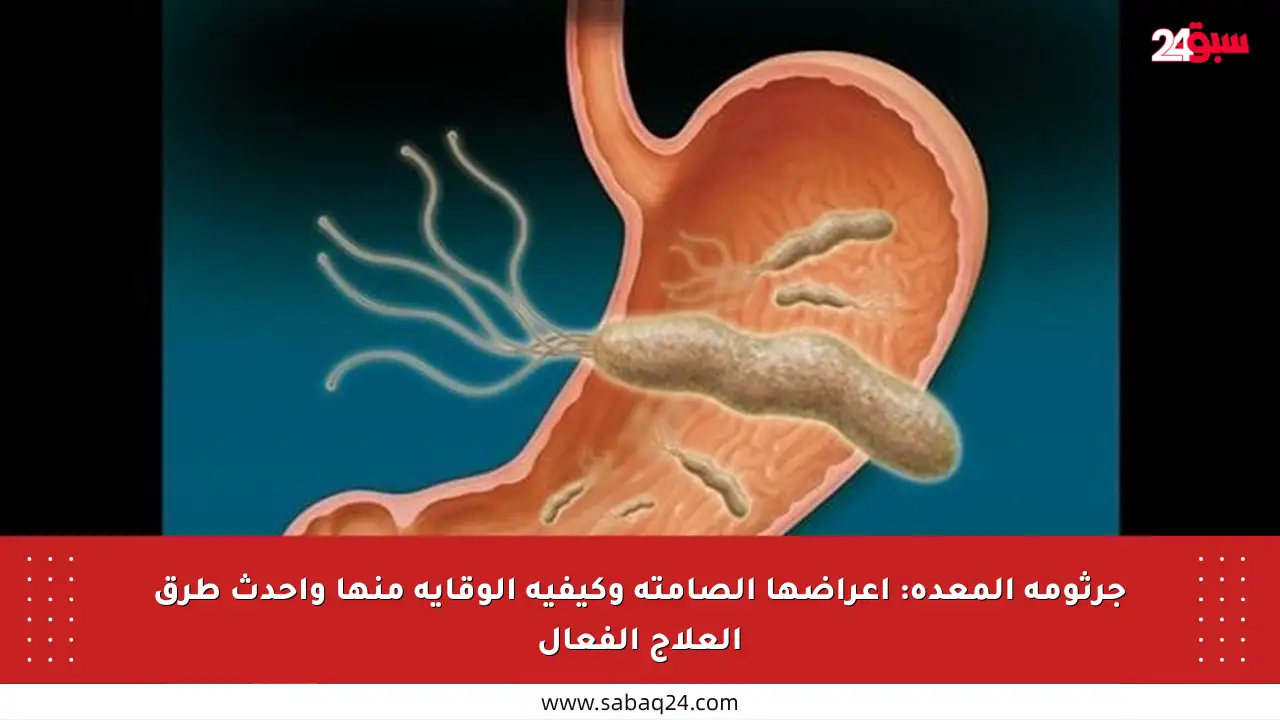 جرثومة المعدة: أعراضها الصامتة وكيفية الوقاية منها وأحدث طرق العلاج الفعال